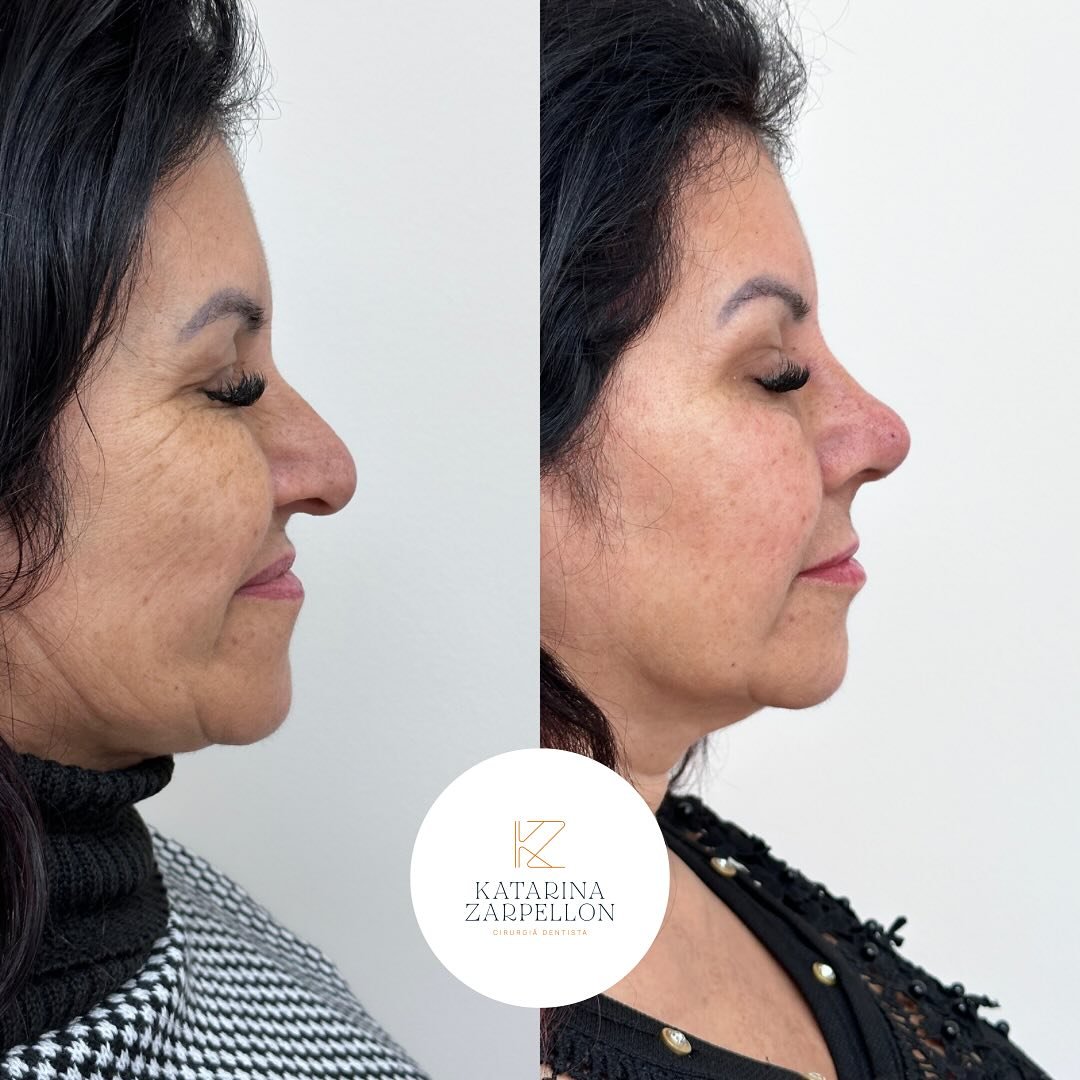 katarinazarpellon_instagram 02